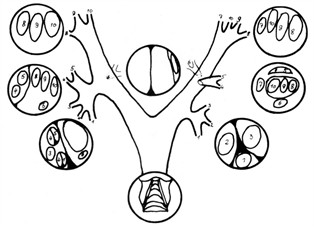 Grafik Laryngo-Tracheo-Bronchialraum, Prof. E. Stoelben