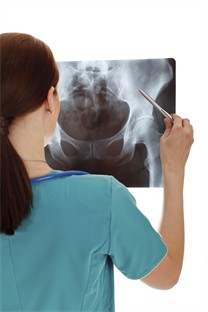 Röntgenbild Hüfte, Foto: Nobilior - iStock