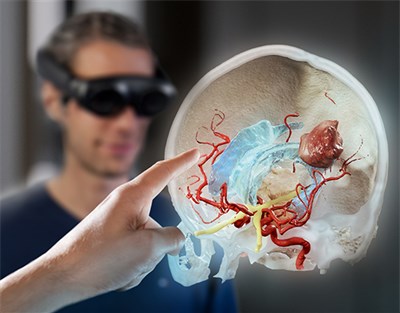 Bilddaten des Gehirns in 3D, Foto: © Brainlab