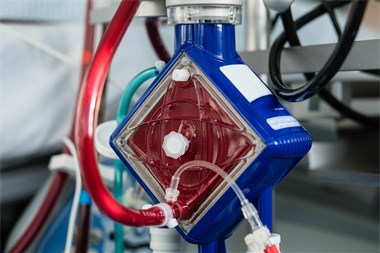 Das Blut wird in der ECMO-Maschine über einen Membran-Oxygenator mit Sauerstoff versorgt und vom Kohlendioxid befreit, ©Karagiannidis